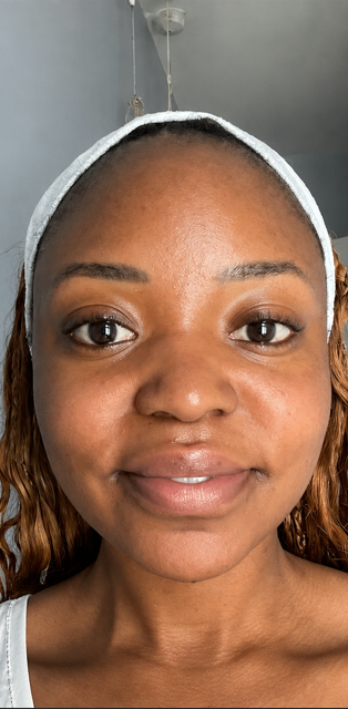 Skin after 14 days of using the serum — brighter, smoother and more even