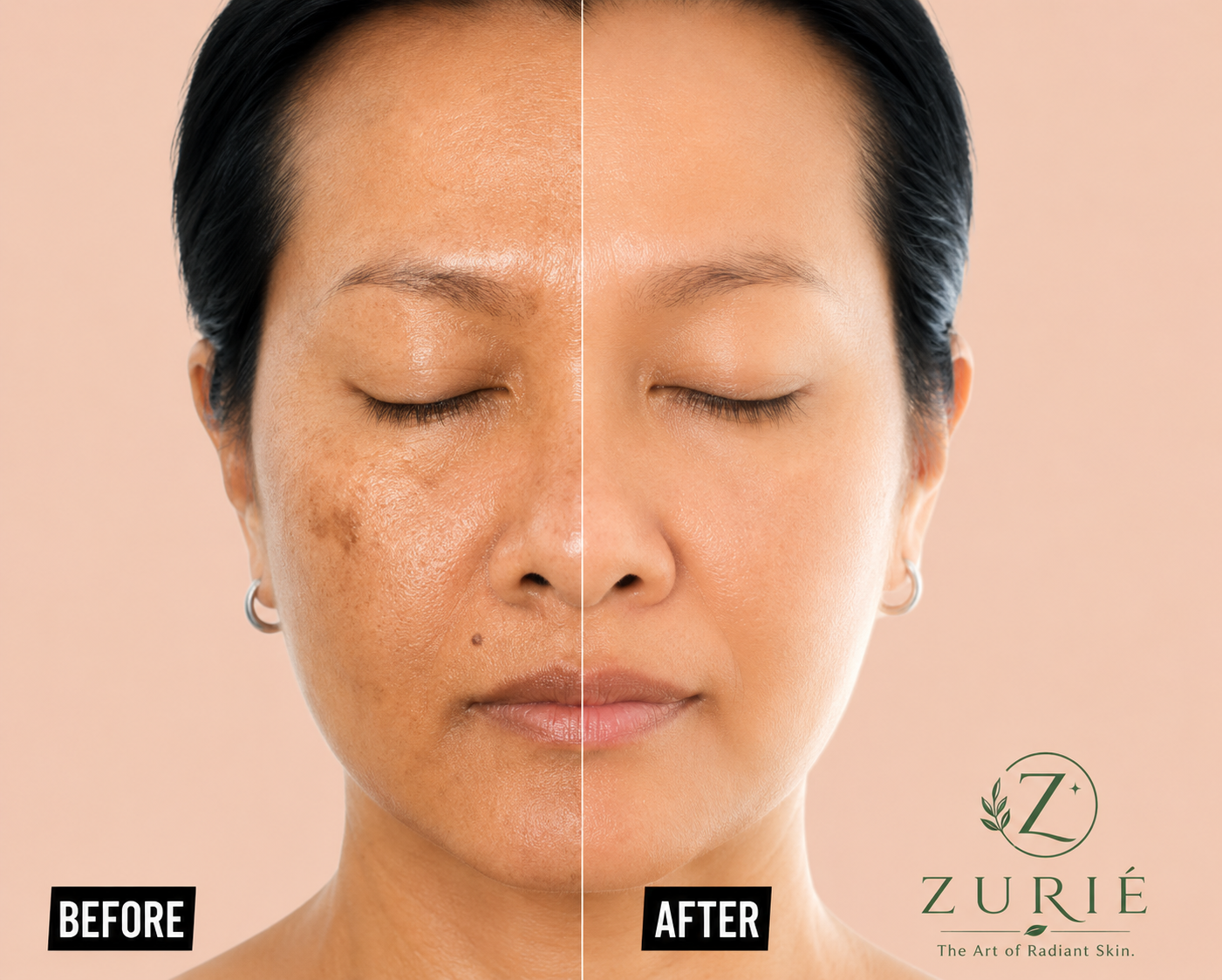 Before and after skin transformation using Axis Y Dark Spot Correcting Serum