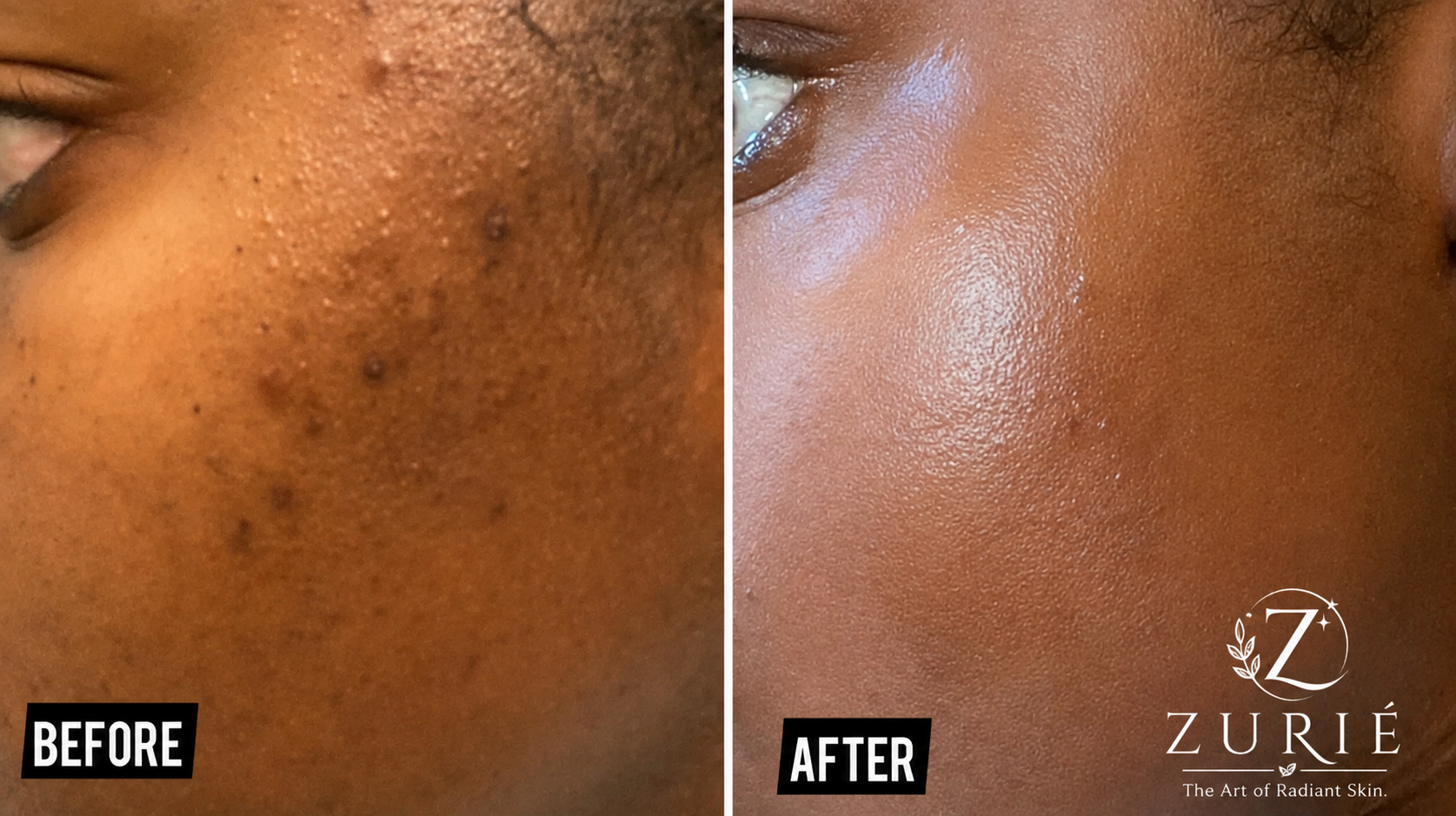 Before and after results using Axis Y Dark Spot Correcting Serum